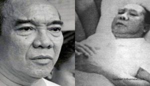 penyebab kematian soekarno