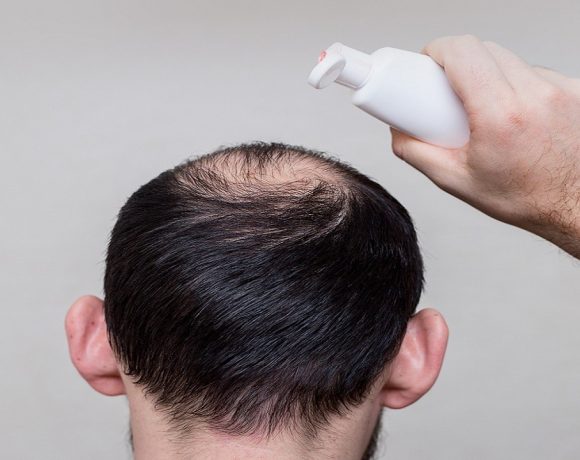 5 Rekomendasi Shampo Penumbuh Rambut Terbaik 2023, Makin Lebat dan Kuat!