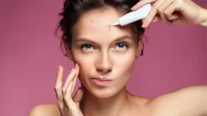 urutan pemakaian acnes treatment series